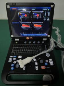 Portátil portátil Color Ultrasonido Escáner Máquina 3D Notebook tipo ultrasonido - Product Image 3