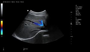 Échographe portable Zoncare P7 à livraison rapide et échographe Doppler couleur 3D 4D pour usage hospitalier humain avec une qualité parfaite - Product Image 5