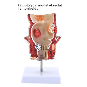 बड़ी आंत पैथोलॉजी मॉडल सिलिकॉन अंग और गैस्ट्रोइंटेस्टाइनल और कोलन रोग के लिए हेड मॉडल - Product Image 3