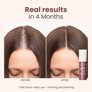 Fabrik-Förderung Neues Haarwachstum Haarausfall-Regeneration Gesichtshaar-<span class=keywords><strong>Spray</strong></span> für Kinder Balanciert Kopfhautgesundheit Revitalisierendes Serum - Product Image 3