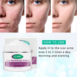 Crème pour le visage ELAIMEI contre les brûlures et les cicatrices, logo personnalisé, lissante, raffermissante, anti-vergetures, crème réparatrice pour toutes les cicatrices - Product Image 2