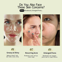 Sérum Anti-Acné à l'Acide Salicylique et au Niacinamide Marque Blanche Usine – Sérum Visage Purifiant et Séborégulateur pour Réduire les Points Noirs – Soin de la Peau