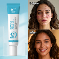 Produits de soin de la peau, gel contre l'acné à l'acide salicylique, traitement rapide de l'acné et des taches brunes en 12 heures, certifié COA, pour les rougeurs et les boutons, 20g