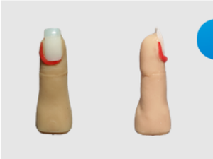 Modelo <span class=keywords><strong>de</strong></span> simulación <span class=keywords><strong>de</strong></span> eliminación <span class=keywords><strong>de</strong></span> uñas encarnadas <span class=keywords><strong>de</strong></span> PVC realista para estudiantes <span class=keywords><strong>de</strong></span> medicina, práctica <span class=keywords><strong>de</strong></span> <span class=keywords><strong>drenaje</strong></span> <span class=keywords><strong>de</strong></span> corte quirúrgico, ciencia médica - Product Image 4