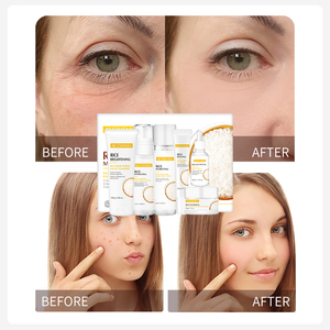 AESTHTANY - Crema Esencial Limpiadora Facial Hidratante y Aclarante de Arroz Puro, Producto Natural <span class=keywords><strong>para</strong></span> el Cuidado de <span class=keywords><strong>la</strong></span> <span class=keywords><strong>Piel</strong></span>, Marca Privada, Gran Venta - Product Image 3