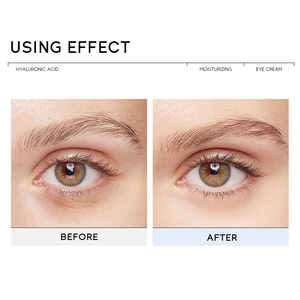 Sérum Crème Anti-Âge Contour des Yeux à l'Acide Hyaluronique Bio – Soin Anti-Rides, Anti-Poches et Anti-Cernes OBM - Product Image 3