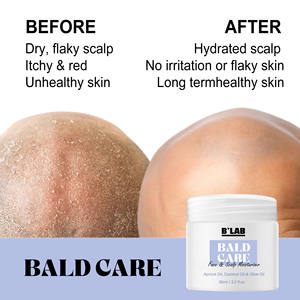 Nouveautés : Crème capillaire pour hommes pour le soin des têtes chauves, hydratant capillaire Everyady, soin du cuir chevelu, fini mat, sans gras, crème végane pour le soin des têtes chauves - Product Image 4