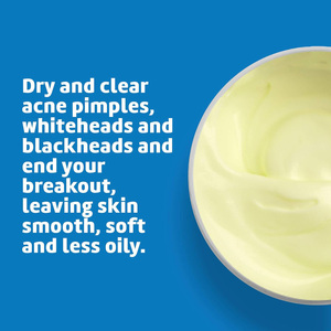 <span class=keywords><strong>Pommade</strong></span> au soufre Crème à base de soufre <span class=keywords><strong>pour</strong></span> le visage et le corps Anti Pimple Remover - Product Image 3