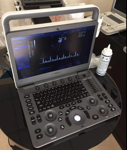 Ecógrafo Portátil <span class=keywords><strong>SonoScape</strong></span> <span class=keywords><strong>E1</strong></span> ExpV con Doppler Color para Diagnóstico Veterinario - Product Image 3