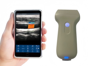 Sonda Inalámbrica Doppler a Color DMU86, Escáner de Ultrasonido Inalámbrico Portátil, Sonda Lineal con el Mejor Precio - Product Image 1