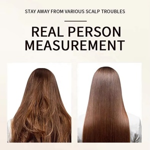 Nizo OEM 24 horas calmante Cuidado del cuero cabelludo champú Reino Unido Venta caliente para <span class=keywords><strong>eczema</strong></span> seco El cabello rizado propenso ofrece un alivio continuo suave y sedoso - Product Image 3