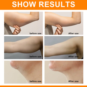 Savon biologique au gingembre EELHOE pour le drainage lymphatique, détoxifiant, <span class=keywords><strong>nettoyant</strong></span> hydratant pour le <span class=keywords><strong>visage</strong></span>, déboucheur de pores, éliminateur de graisse, savon artisanal chinois - Product Image 6