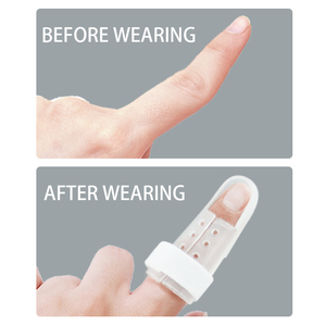 Fabriek Directe Verkoop Medische Aluminium Vinger Ondersteuning Waterdicht Pinky Vinger Spalk - Product Image 5