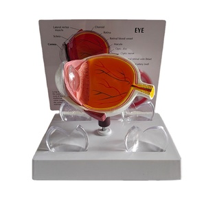 Modelo Anatómico Patológico del Ojo Humano, Modelo de Exhibición de Enfermedades de la Córnea para Enseñanza Médica - Product Image 1