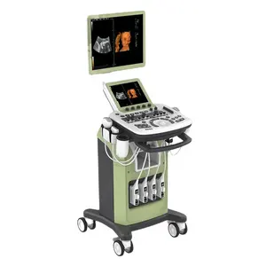 Machine à ultrasons de chariot de couleur de la meilleure qualité de la Chine, système à ultrasons de diagnostic pour la clinique