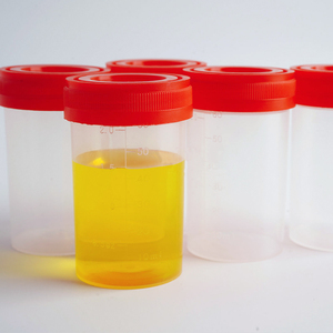 120ml vô trùng nhựa PP nước tiểu Bộ sưu tập <span class=keywords><strong>container</strong></span> tốt Nghiệp Mẫu Cup cho bệnh nhân trong các bệnh viện OEM tùy chỉnh - Product Image 3