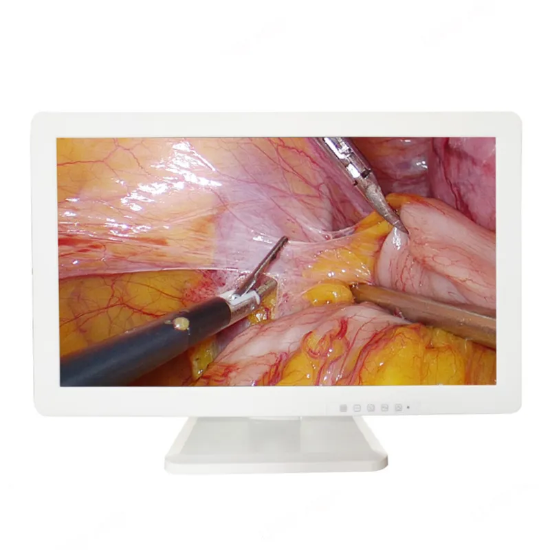 Moniteur médical d'endoscope de PC pour la tour de laparoscopie