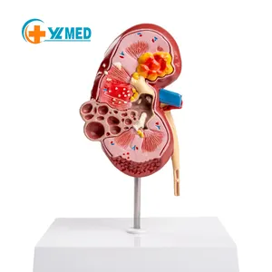 teaching kidney anatomical model urinary system anatomy human kidney model human plastic kidney anatomic model