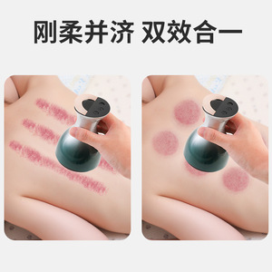Electric Cupping Device ZS 0016 Infrared Therapy Rechargeable Full Body Pain Relief - Product Image 4