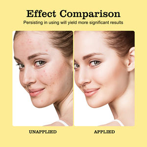 Serum Pemutih Pengencang Pengurang Pori-pori Anti-Kerut Asam Ferulic Vitamin C E Vegan Organik Label Pribadi - Product Image 5