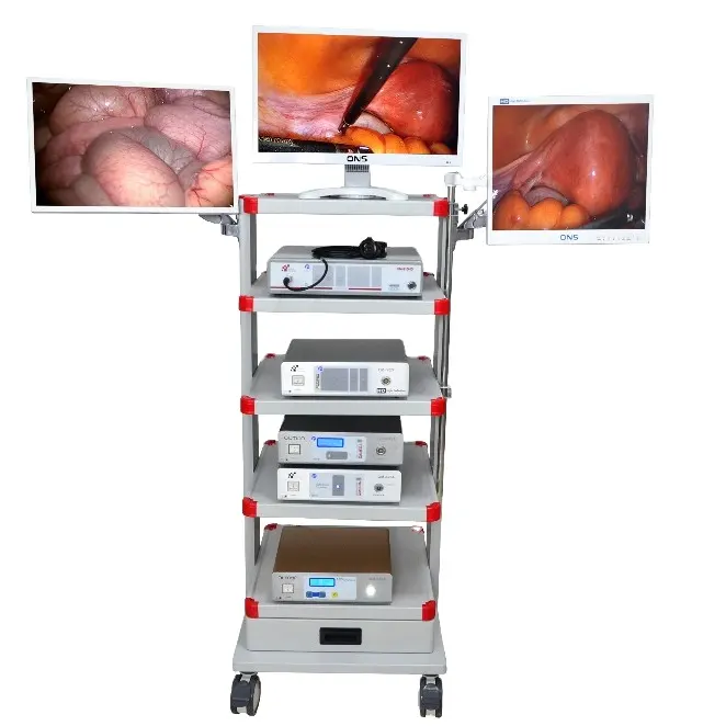 1080P Endoscopy Camera System for ENT Hysteroscopy endoscope Surgery