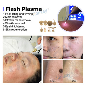 Stylo <span class=keywords><strong>plasma</strong></span> à double canal chaud et froid pour lifting du visage, réparation des vergetures, anti-âge, clinique de soins de la peau, appareil <span class=keywords><strong>plasma</strong></span> froid, vente rapide - Product Image 4