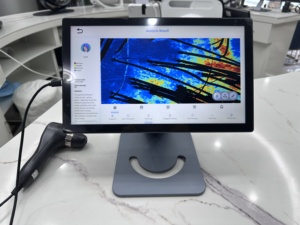 Machine d'analyse du cuir chevelu intelligente à IA de haute précision avec comparaison avant/après, détecteur de cuir chevelu - Product Image 4