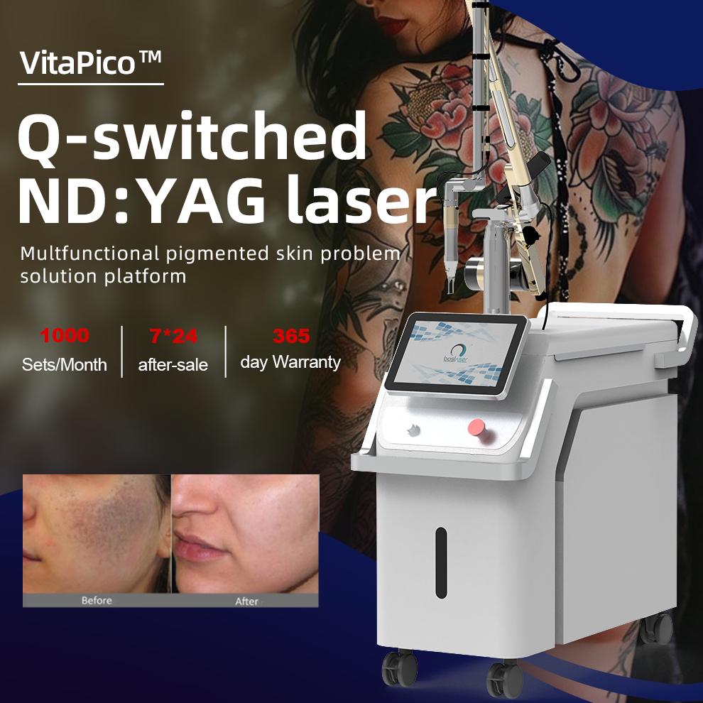 Q-switched nd yag -Single lamp double rod