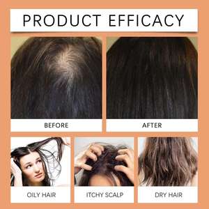 クロスボーダー専用髪再成長ローズマリー育毛刺激器強化ヘアエッセンス100% 天然バタナオイル - Product Image 4