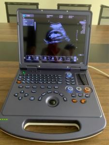 Échographe 3D 4D rentable pour usage humain - Product Image 5