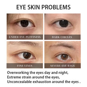 Organic Herbal Hyaluronic Acid Moisturizing Under <b>Eye</b> Gel Pads Crystal <b>Eye</b> <b>Mask</b> <b>Collagen</b> Anti-Wrinkle Blue Patch for Dry Skin - Product Image 6