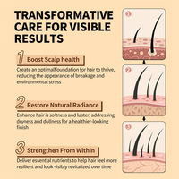 Minyak Pertumbuhan Rambut Jahe SEVICH RTS 20ml, Esens Pertumbuhan Rambut Alami Herbal, Perawatan Anti-Rambut Rontok, Pertumbuhan Cepat