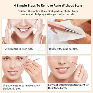 ชุดเครื่องมือกำจัดสิวหัวดำโรสโกลด์6ชิ้น - Product Image 5