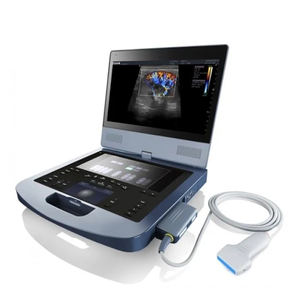 Sistema de Ultrasonido Portátil para Diagnóstico en Obstetricia, Ginecología, Pediatría y Urología - Product Image 1