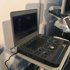 Портативный цветной Доплеровский Ультразвуковой Сканер - Product Image 6