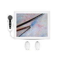 Mesin perawatan kulit kepala penganalisa kulit kepala 4 windows Laptop tipe penganalisa kulit mesin analisis Perbesar folikel rambut kulit kepala