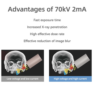 Trung Quốc Nhà sản xuất kỹ thuật số Xray Máy nha khoa Xray <span class=keywords><strong>x</strong></span>ách tay Xray thú y nha khoa cụ nha khoa thiết bị phòng thí nghiệm - Product Image 4