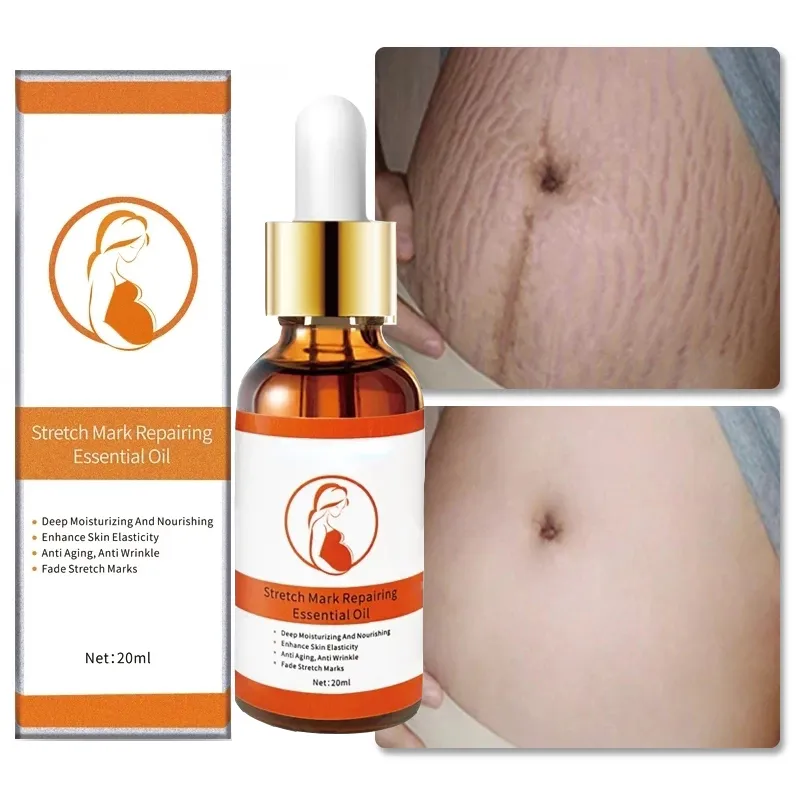 Huile essentielle anti-vergetures Soin de la peau Crème anti-vergetures Pour l'élimination des vergetures Slackline de maternité pour les huiles enceintes