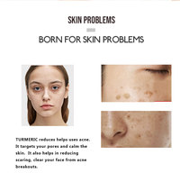 Sérum Visage au Curcuma et Vitamine C Marque Privée OEM ODM Personnalisé Hydratant Éclaircissant Lissant Soin de la Peau du Visage