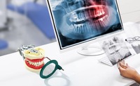 Système de positionnement de film radiographique dentaire, kit de positionnement électrique en plastique, support de positionnement, localisateur, outils et instruments dentaires