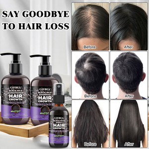 OEM de lujo <span class=keywords><strong>mejor</strong></span> anti <span class=keywords><strong>caída</strong></span> <span class=keywords><strong>del</strong></span> <span class=keywords><strong>cabello</strong></span> champú Biotin queratina crecimiento <span class=keywords><strong>del</strong></span> <span class=keywords><strong>cabello</strong></span> champú y acondicionador <span class=keywords><strong>para</strong></span> <span class=keywords><strong>la</strong></span> <span class=keywords><strong>caída</strong></span> <span class=keywords><strong>del</strong></span> <span class=keywords><strong>cabello</strong></span> - Product Image 6