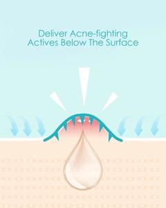 Anti-Aging anti-kırışıklık göz alanı altında en kaliteli göz maskesi mikro-iğne göz yamaları - Product Image 5