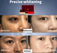 Ensemble de soins de la peau éclaircissants pour le visage à la vitamine C, 3 pièces, sérum et crème, éliminateur de taches brunes, correcteur de pigmentation, meilleur ensemble éclaircissant pour la peau