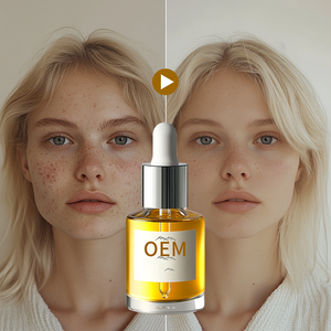 OEM essence de blanchiment personnalisée niacinamide arbutine hydratation anti-âge hydratante salon de beauté essence d'extrait de plante avancée - Product Image 1