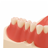 Prothèse complète en acrylique à aspiration complète pour la mâchoire supérieure, prothèse dentaire pour dents édentées