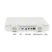 Appareil d'échographie médical portable pour humains, grand écran de 15 pouces, approuvé CE ISO, Mindray DP-20 DP-50