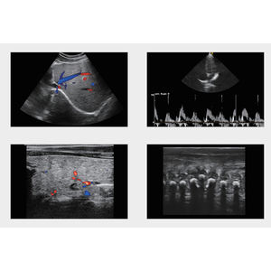 Instrumento Médico de Ultrasonido 4D/5D, Escáner de Ultrasonido, Instrumento de Diagnóstico por Ultrasonido a Color de Alta Definición - Product Image 6