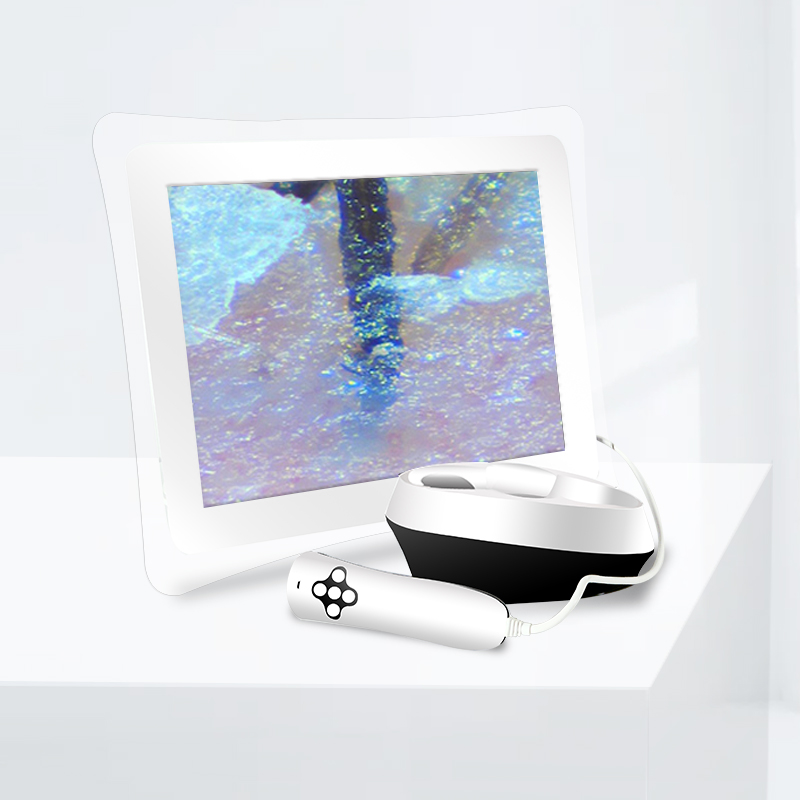 3D смарт-15-дюймовый сенсорный экран Смарт-сетей портативный оборудование для салонов красоты для ухода за кожей лица тест кожи анализа