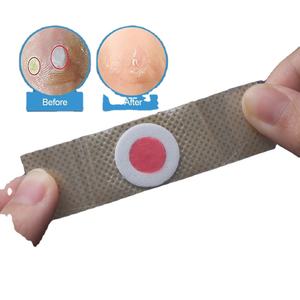 Parche de eliminación de maíz para pies Sumifun, callos plantares, alivio del dolor, almohadilla de yeso médico, herramienta de pedicura para el cuidado antifricción - Product Image 4