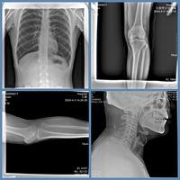 Appareil de radiographie portable pour chiens avec détecteur à écran plat tactile pour le diagnostic des animaux dans les cliniques vétérinaires